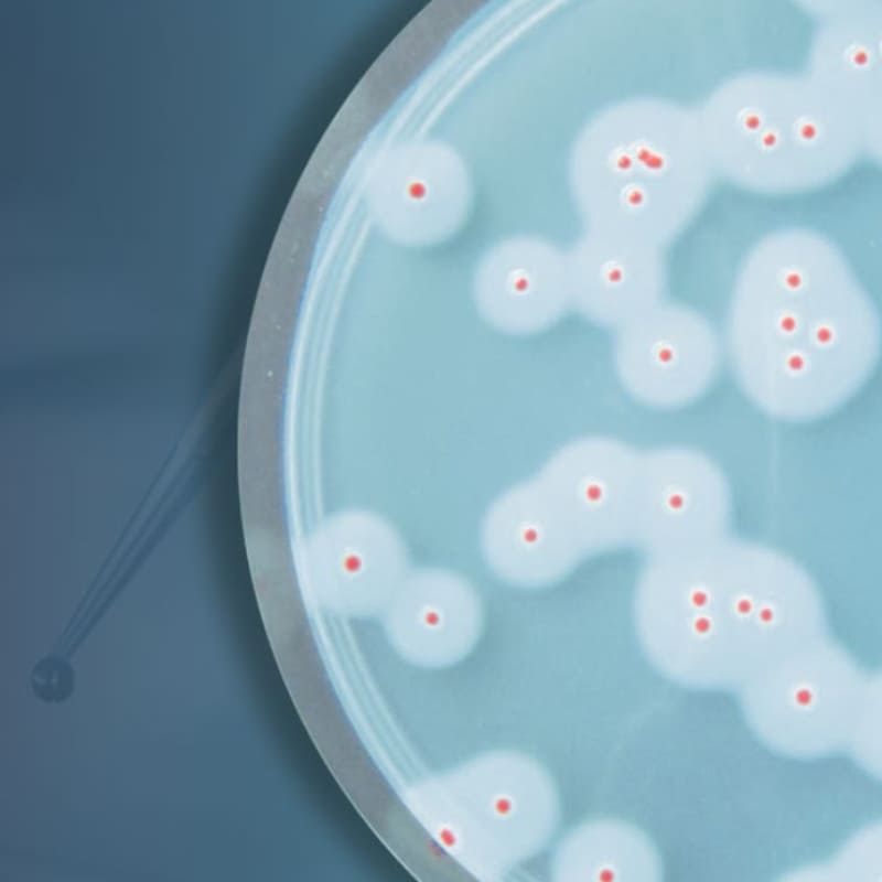 Вебинар «Лабораторный контроль Bacillus cereus»