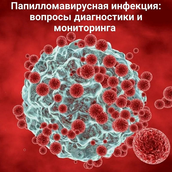 Цикл онлайн-семинаров «Папилломавирусная инфекция: вопросы диагностики и мониторинга»